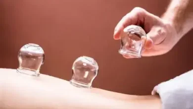 مركز حجامة في جدة