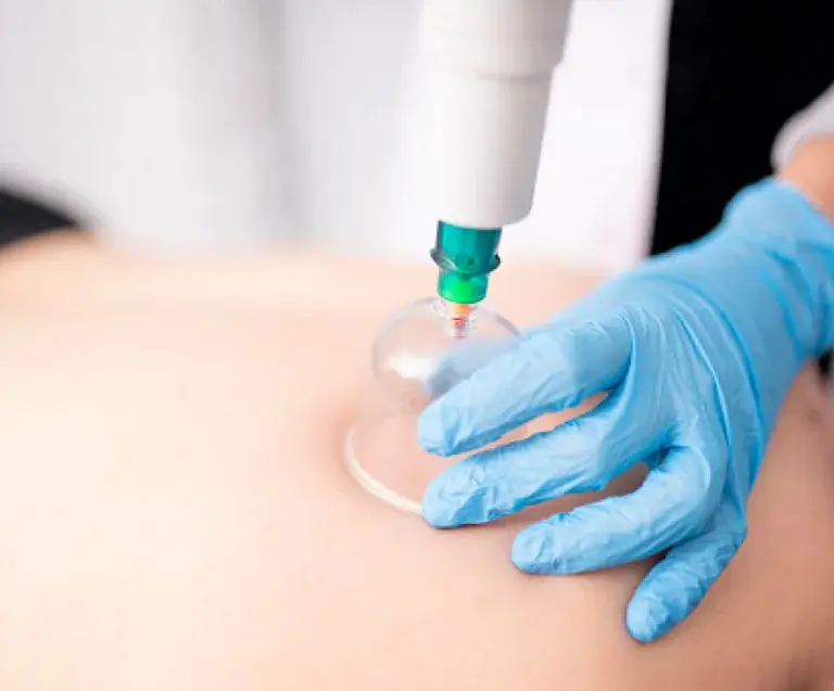 مركز حجامة في جدة 